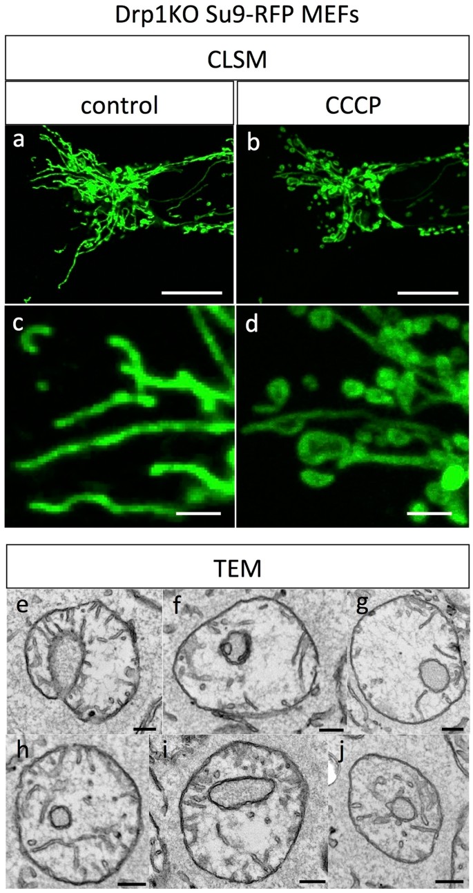 Uncoupled Mitochondria Quickly Shorten Along Their Long Axis To Form Indented Spheroids Instead Of Rings In A Fission Independent Manner Scientific Reports