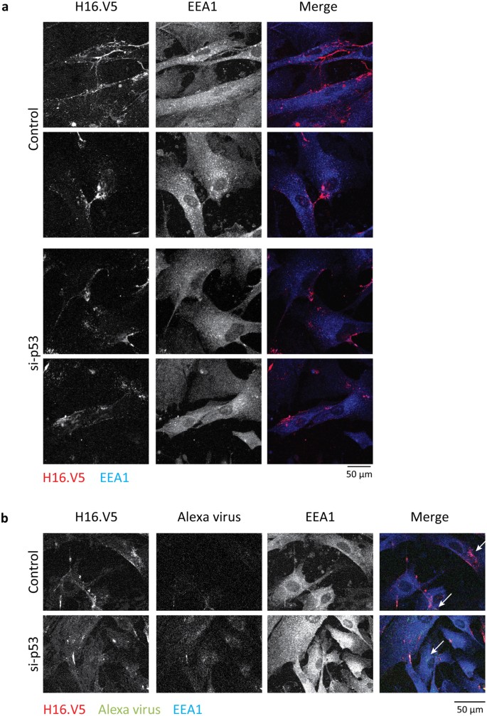 papilloma vírus h16