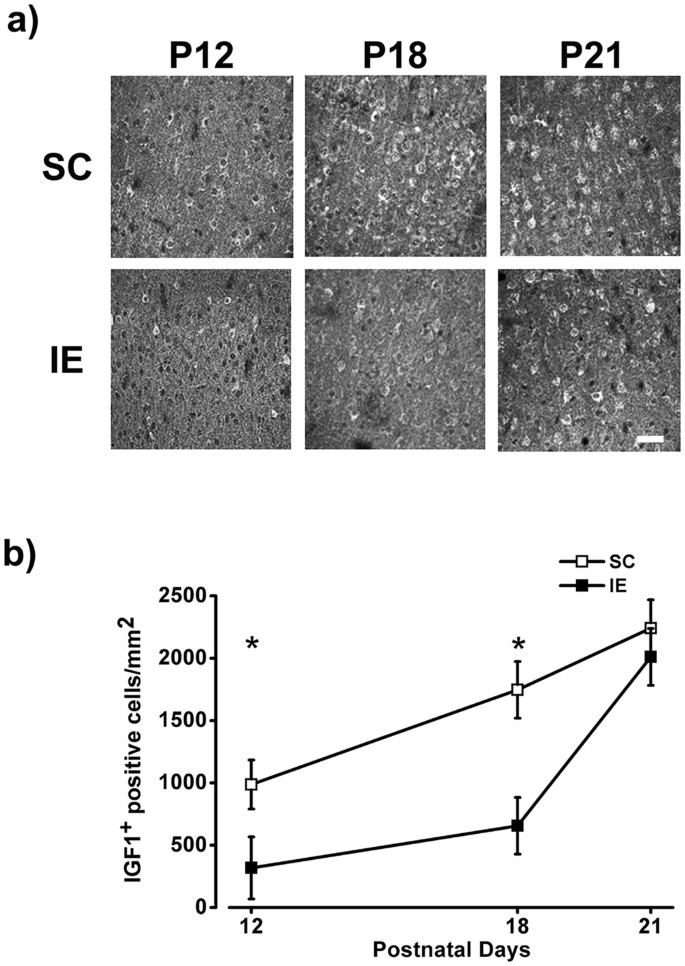 Early Impoverished Environment Delays The Maturation Of Cerebral Cortex Scientific Reports