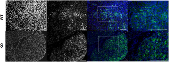 Targeted Mutation Of Ngn3 Gene Disrupts Pancreatic Endocrine Cell Development In Pigs Scientific Reports Targeted Mutation Of Ngn3 Gene Disrupts Pancreatic Endocrine Cell Development In Pigs Scientific Reports