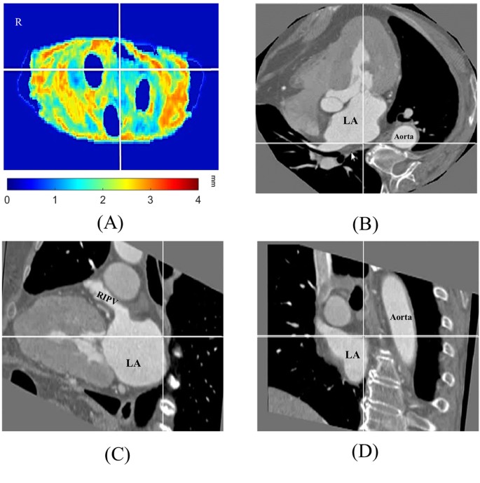 figure 11