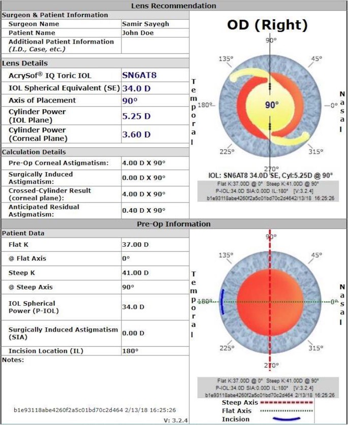 A Direct Method for Determining Toricity Ratios of Toric Intraocular Lens  Calculators | Scientific Reports