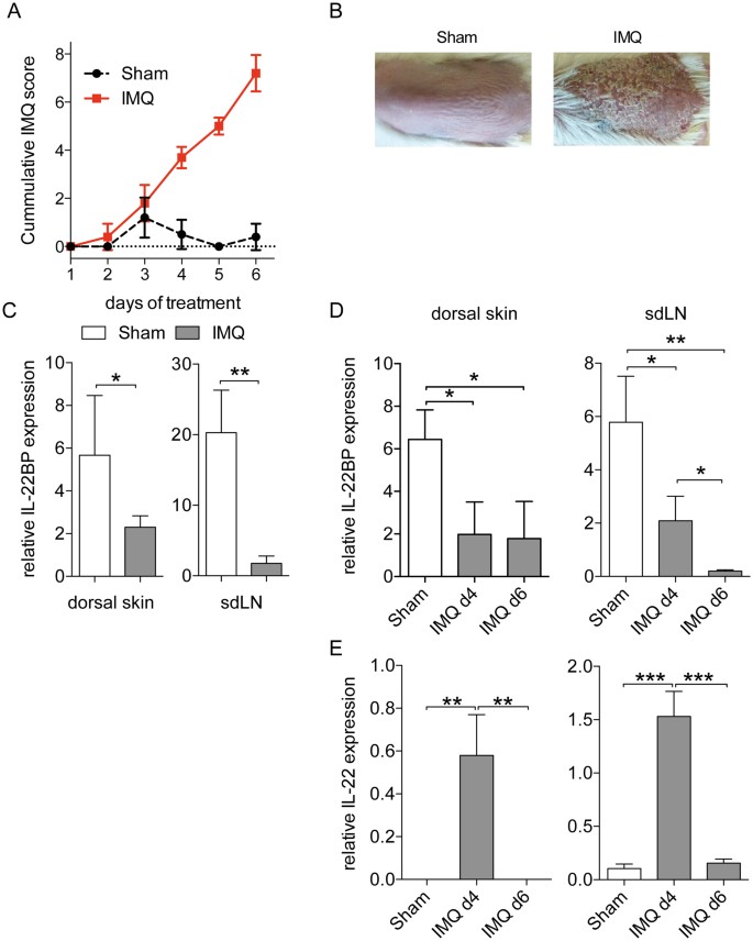 Regulation Of Il 22bp In Psoriasis Scientific Reports Regulation Of Il 22bp In Psoriasis Scientific Reports