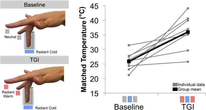 Ineffectiveness of tactile gating shows cortical basis of nociceptive  signaling in the Thermal Grill Illusion | Scientific Reports