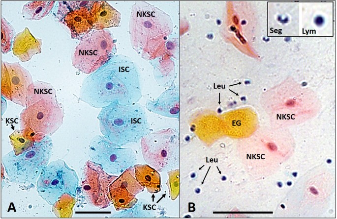 Quantitation Of The Cellular Content Of Saliva And Buccal Swab Samples Scientific Reports