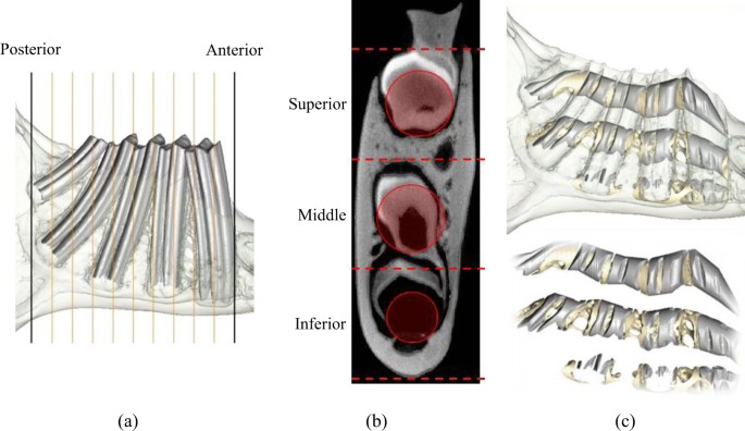 Diagrammatic representation of the normal anatomy of the mandibular