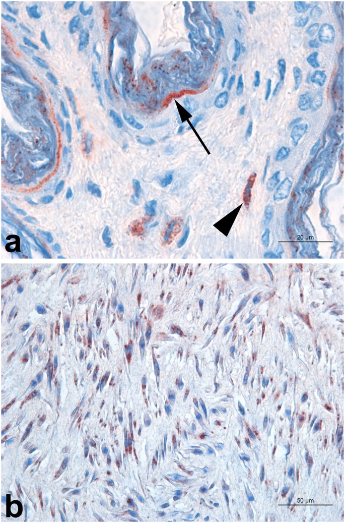 Cell and Tissue Tropism of Brucella spp.