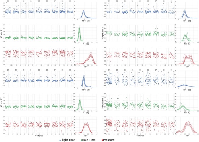 Touchscreen Typing Pattern Analysis For Detecting Fine Motor Skills Decline In Early Stage Parkinson S Disease Scientific Reports