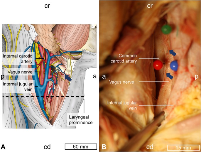 Cervical Vagus Nerve Morphometry And Vascularity In The