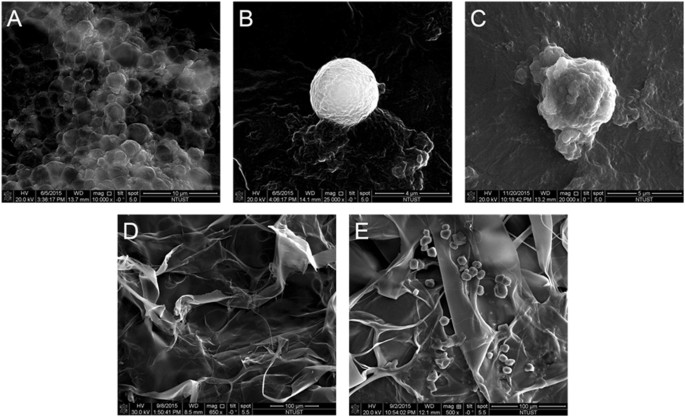 Ultrasound-Mediated EGF-Coated-Microbubble Cavitation in Dressings for  Wound-Healing Applications | Scientific Reports