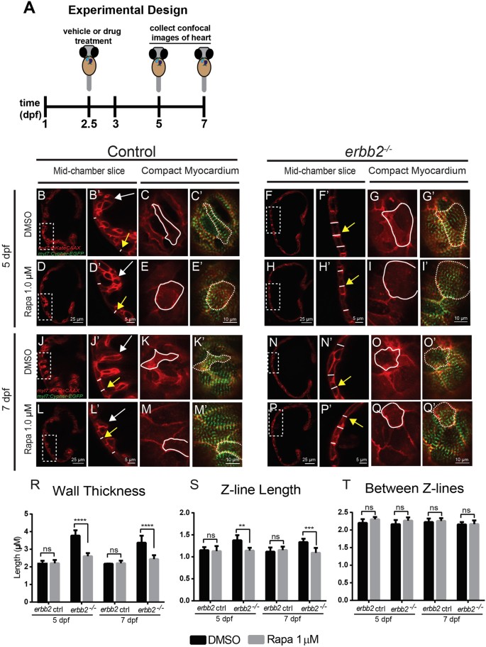 Rapamycin Attenuates Pathological Hypertrophy Caused By An Absence Of Trabecular Formation Scientific Reports