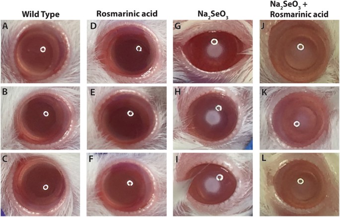 Rosmarinic Acid Restores Complete Transparency of Sonicated Human Cataract  Ex Vivo and Delays Cataract Formation In Vivo | Scientific Reports