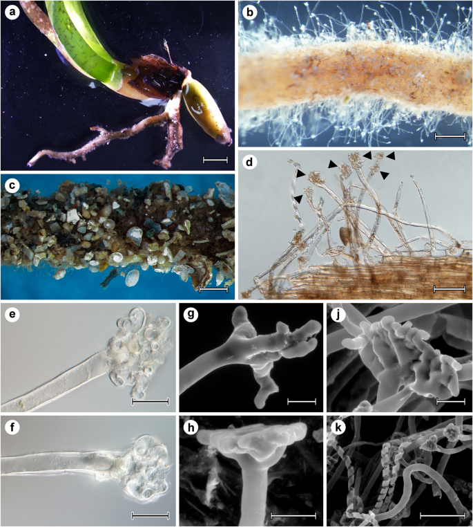 Ontogenetic Transition From Specialized Root Hairs To Specific Root Fungus Symbiosis In The Dominant Mediterranean Seagrass Posidonia Oceanica Scientific Reports