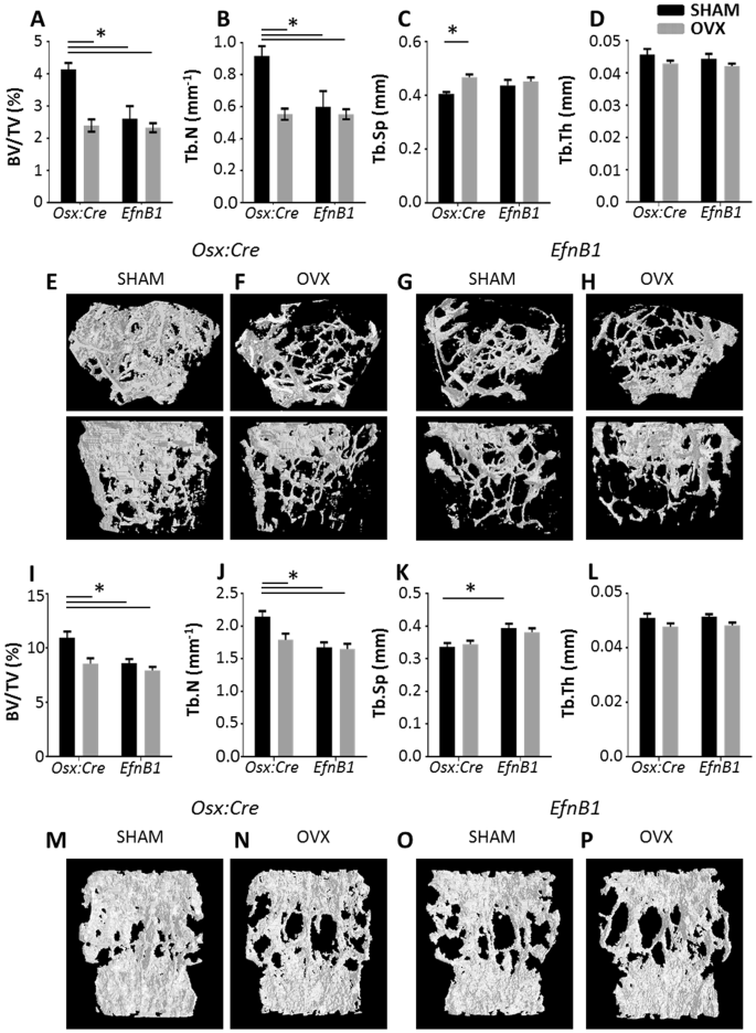 The Osteoprogenitor Specific Loss Of Ephrinb1 Results In An Osteoporotic Phenotype Affecting The Balance Between Bone Formation And Resorption Scientific Reports