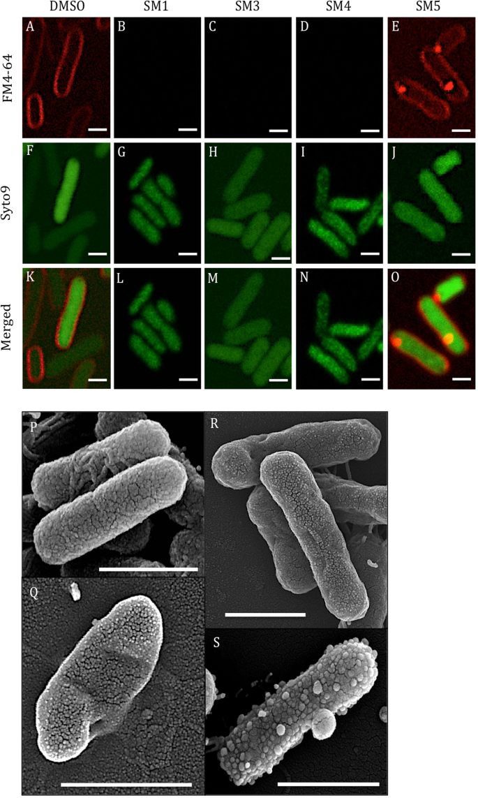 Salmonella enterica