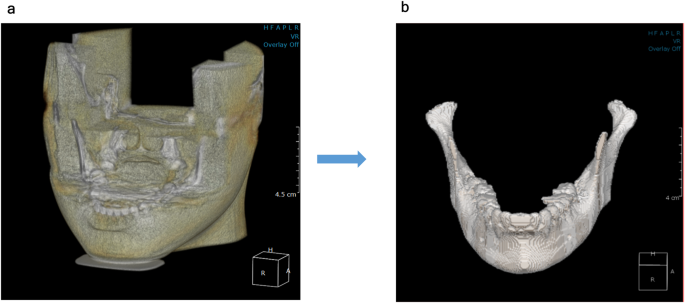 figure5