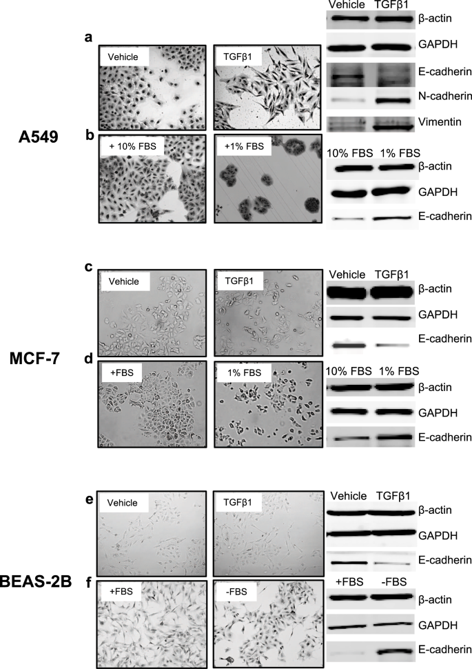 A Novel Mechanism Of Plasminogen Activation In Epithelial And Mesenchymal Cells Scientific Reports