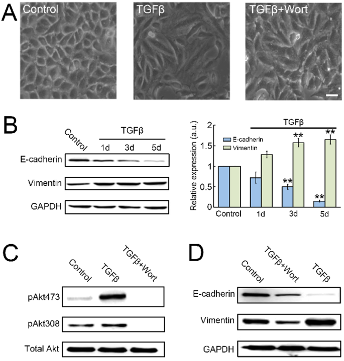 Optogenetic Control Of Epithelial Mesenchymal Transition In Cancer Cells Scientific Reports