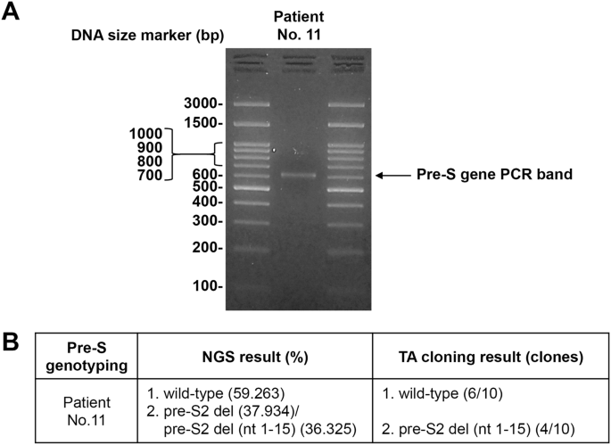 A Next Generation Sequencing Based Platform For Quantitative Detection Of Hepatitis B Virus Pre S Mutants In Plasma Of Hepatocellular Carcinoma Patients Scientific Reports A Next Generation Sequencing Based Platform For Quantitative Detection Of Hepatitis B Virus Pre S Mutants In Plasma Of Hepatocellular Carcinoma Patients Scientific Reports