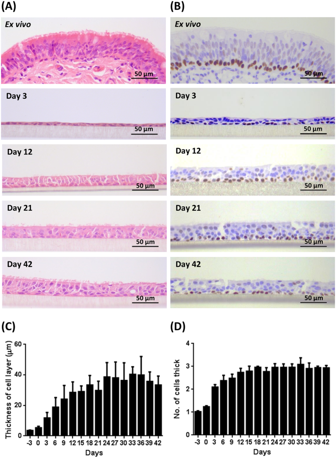 Interaction of Staphylococcus aureus and Host Cells upon Infection of  Bronchial Epithelium during Different Stages of Regeneration