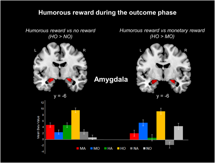 Dissociation Between The Processing Of Humorous And Monetary Rewards In The Motivation And Hedonic Brains Scientific Reports Dissociation Between The Processing Of Humorous And Monetary Rewards In The Motivation And Hedonic Brains Scientific Reports