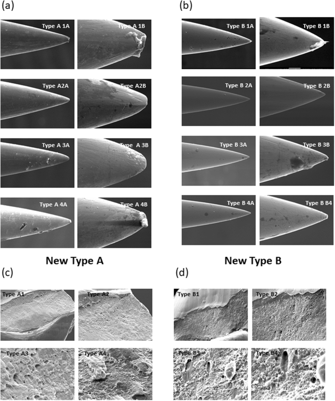 Scanning electron microscopy examination of needle tips after different  procedures of deep dry needling in humans | Scientific Reports