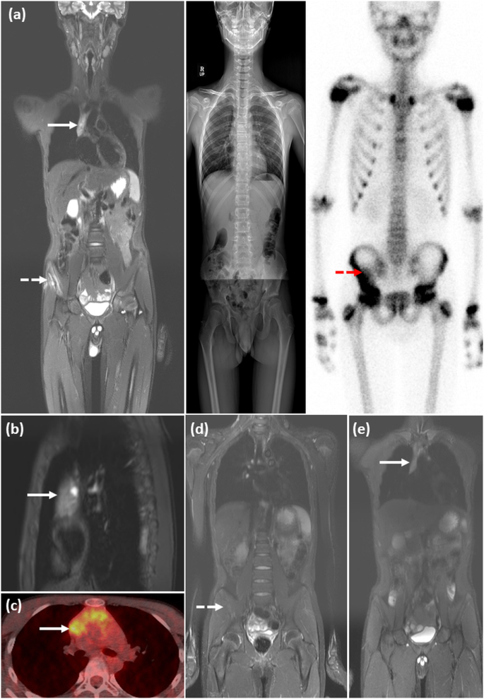 What are the best scans for imaging the body?