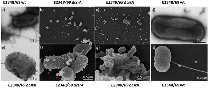 Metabolome And Transcriptome Wide Effects Of The Carbon Storage Regulator A In Enteropathogenic Escherichia Coli Scientific Reports