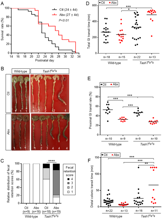Gut Microbiota Mediated Gene Environment Interaction In The Tasht Mouse Model Of Hirschsprung Disease Scientific Reports