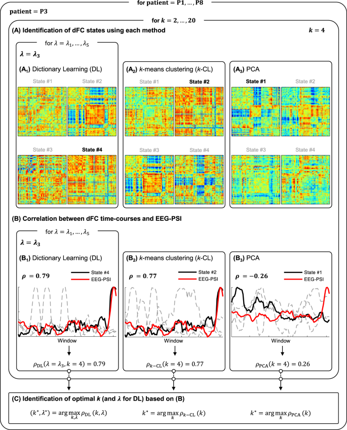Identification Of Epileptic Brain States By Dynamic Functional Connectivity Analysis Of Simultaneous EEG-fMRI: A Dictionary Learning Approach | Scientific Reports Identification Of Epileptic Brain States By Dynamic Functional Connectivity Analysis Of Simultaneous EEG-fMRI: A Dictionary Learning Approach | Scientific Reports