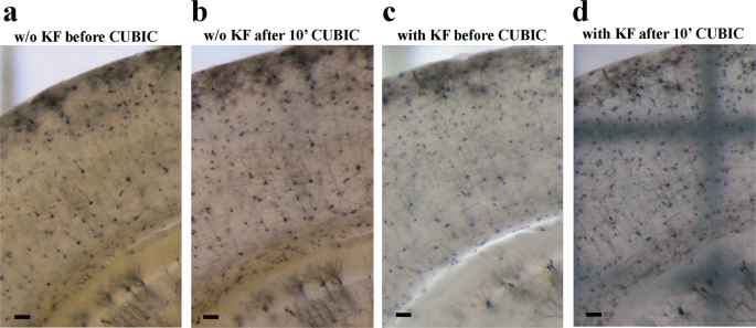 Modernization of Golgi staining techniques for high-resolution,  3-dimensional imaging of individual neurons | Scientific Reports