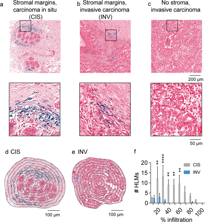 Imaging Endogenous Macrophage Iron Deposits Reveals A Metabolic Biomarker Of Polarized Tumor Macrophage Infiltration And Response To Csf1r Breast Cancer Immunotherapy Scientific Reports