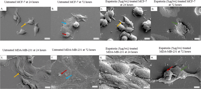 Cytotoxicity Of Eupatorin In Mcf 7 And Mda Mb 231 Human Breast Cancer Cells Via Cell Cycle Arrest Anti Angiogenesis And Induction Of Apoptosis Scientific Reports