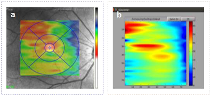 figure 15