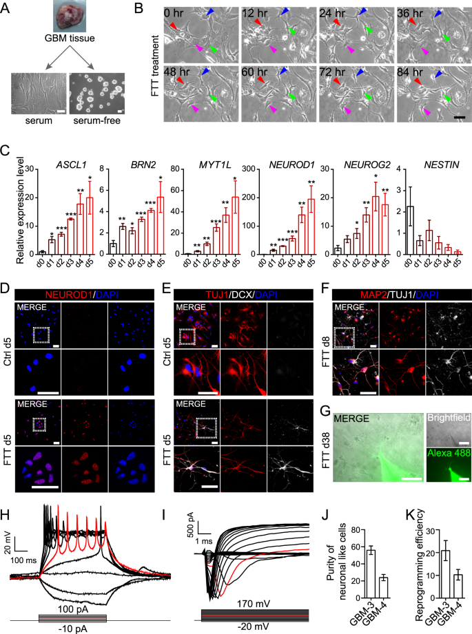 Suppression Of Glioblastoma By A Drug Cocktail Reprogramming Tumor Cells Into Neuronal Like Cells Scientific Reports Suppression Of Glioblastoma By A Drug Cocktail Reprogramming Tumor Cells Into Neuronal Like Cells Scientific Reports