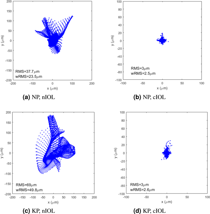 Keratoconic Eyes With Stable Corneal Tomography Could Benefit More From Custom Intraocular Lens Design Than Normal Eyes Scientific Reports Keratoconic Eyes With Stable Corneal Tomography Could Benefit More From Custom Intraocular Lens Design Than Normal Eyes Scientific Reports