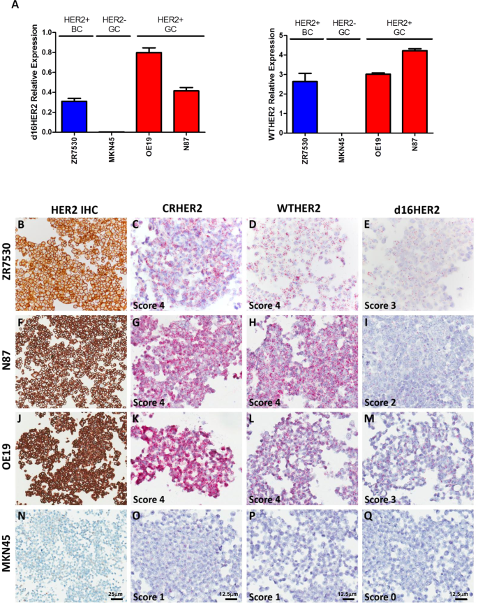 Noninvasive assessment of characteristics of novel anti-HER2