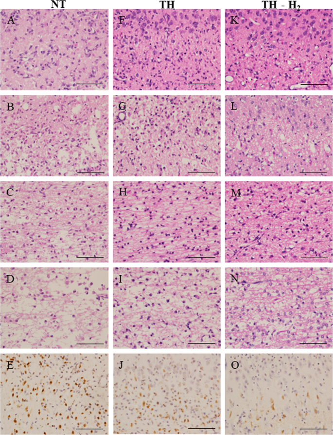 Hydrogen Ventilation Combined With Mild Hypothermia Improves Short Term Neurological Outcomes In A 5 Day Neonatal Hypoxia Ischaemia Piglet Model Scientific Reports Hydrogen Ventilation Combined With Mild Hypothermia Improves Short Term Neurological Outcomes In A 5 Day Neonatal Hypoxia Ischaemia Piglet Model Scientific Reports