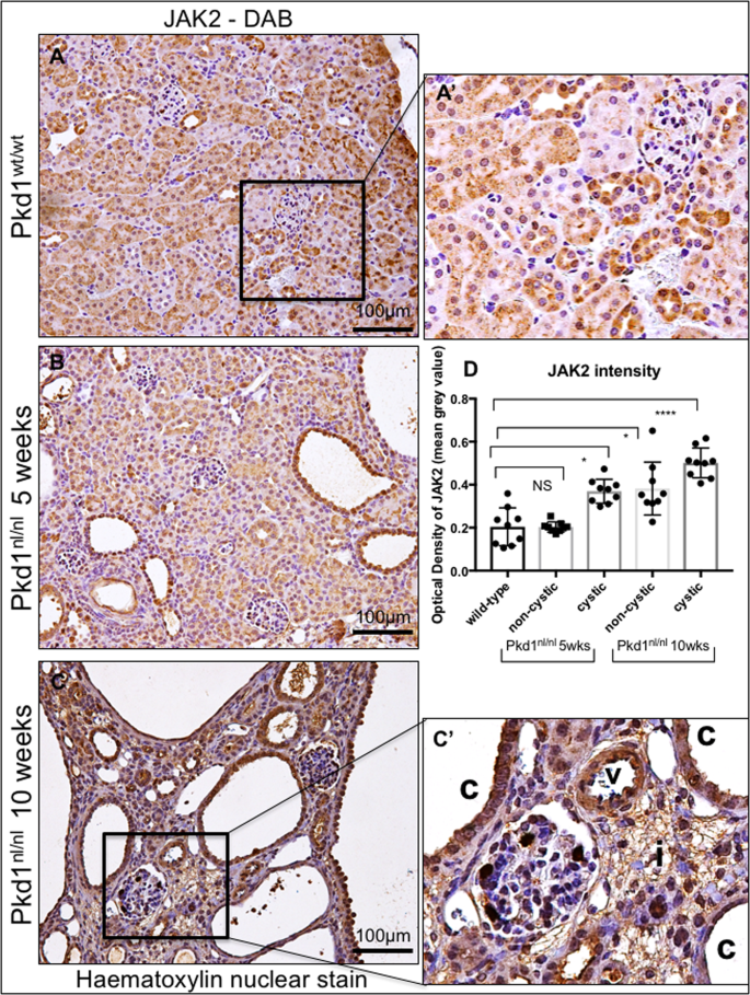 Renal Expression Of Jak2 Is High In Polycystic Kidney Disease And Its Inhibition Reduces Cystogenesis Scientific Reports