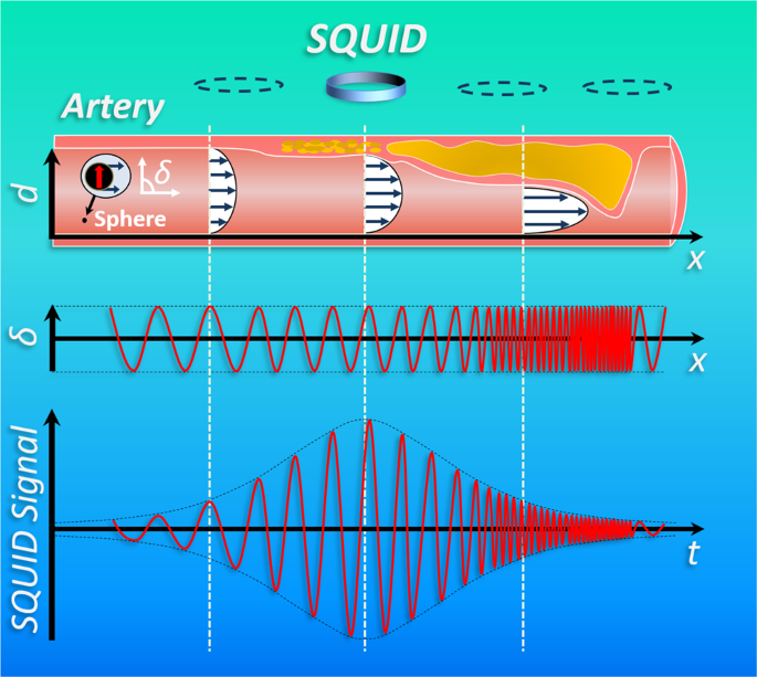 magnetic field interference phantom 3