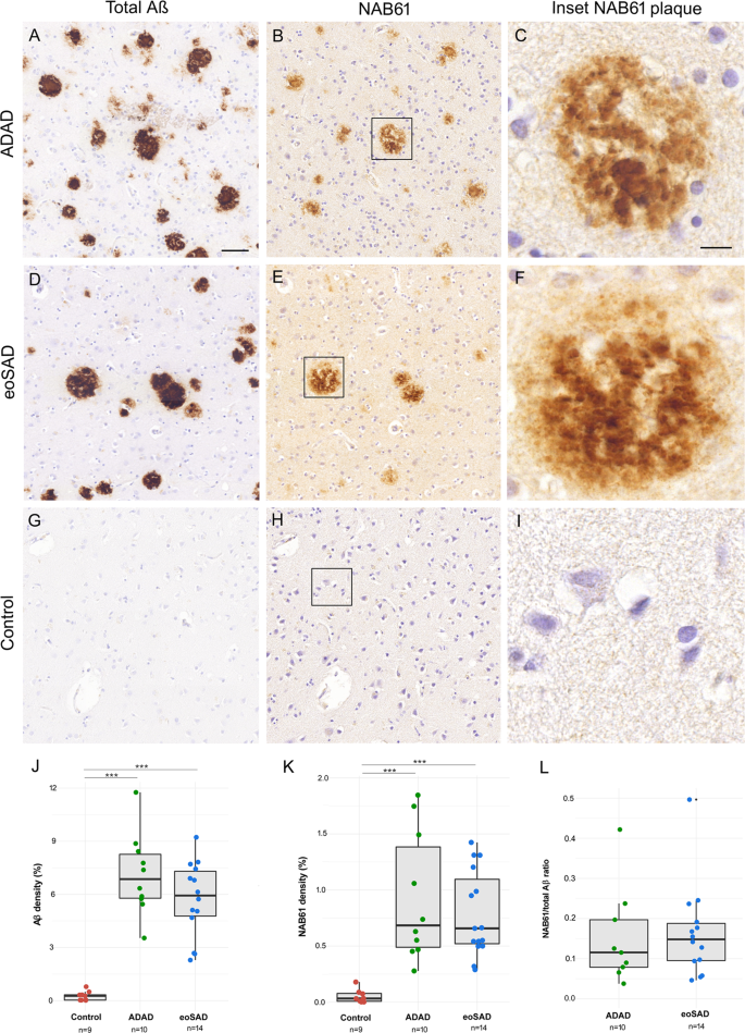 Nanoscale Structure Of Amyloid B Plaques In Alzheimer S Disease Scientific Reports Nanoscale Structure Of Amyloid B Plaques In Alzheimer S Disease Scientific Reports