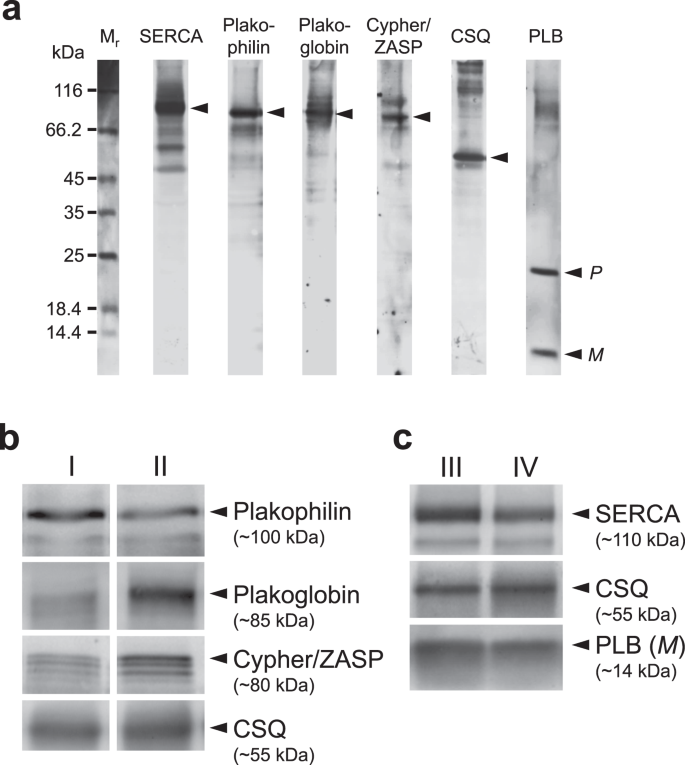 Alterations Of Protein Expression Of Phospholamban Zasp And Plakoglobin In Human Atria In Subgroups Of Seniors Scientific Reports Alterations Of Protein Expression Of Phospholamban Zasp And Plakoglobin In Human Atria In Subgroups Of Seniors Scientific Reports