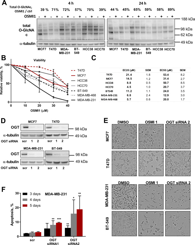 O Glcnac Transferase Inhibition Differentially Affects Breast Cancer Subtypes Scientific Reports