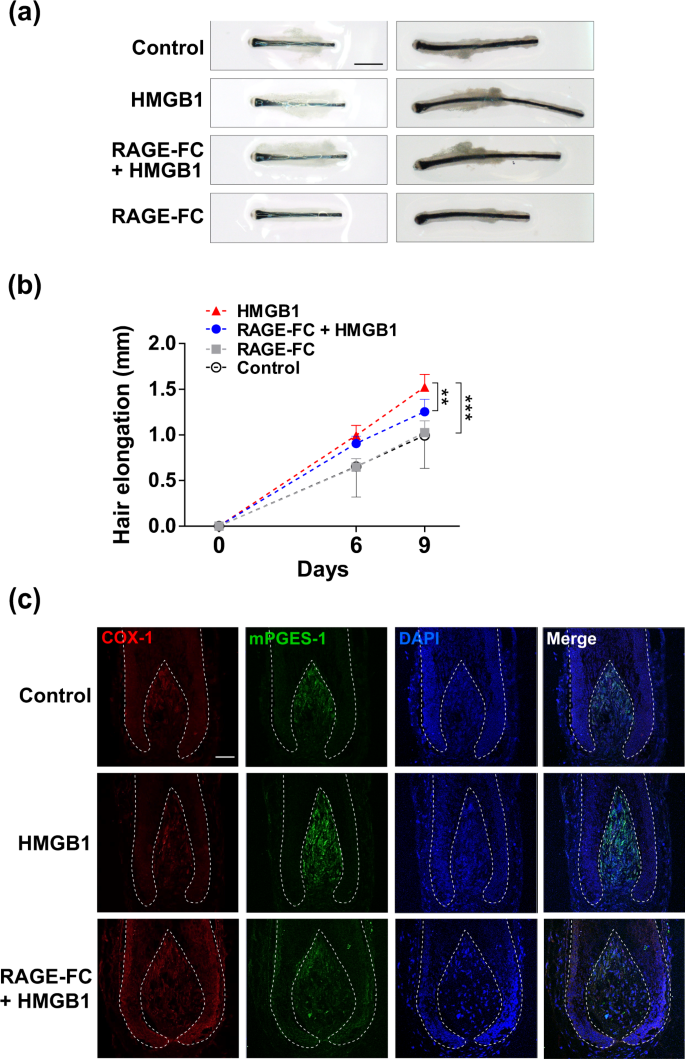 HMGB1 promotes hair growth via the modulation of prostaglandin metabolism |  Scientific Reports