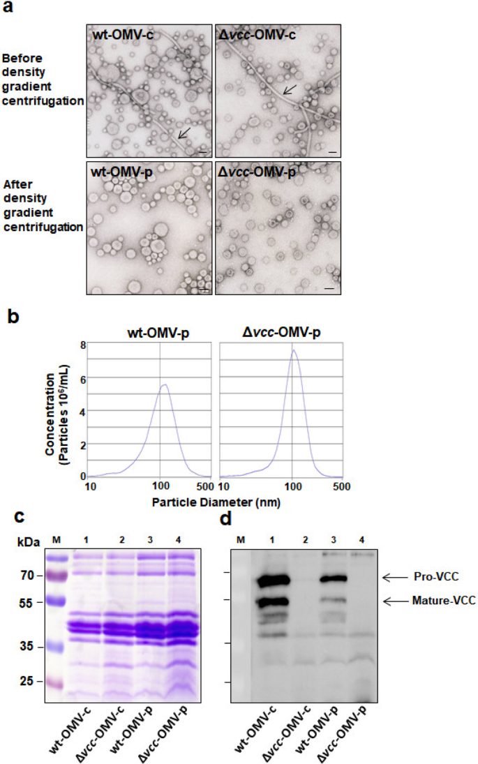 Vibrio Cholerae Derived Outer Membrane Vesicles Modulate The Inflammatory Response Of Human Intestinal Epithelial Cells By Inducing Microrna 146a Scientific Reports