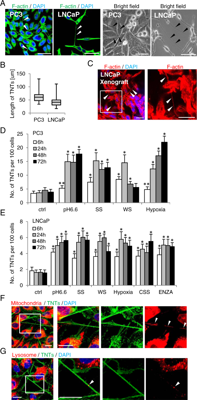 Stress Induced Tunneling Nanotubes Support Treatment Adaptation In Prostate Cancer Scientific Reports