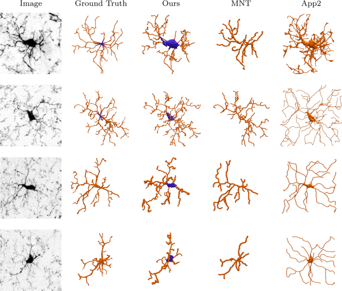 Segmentation Tracing And Quantification Of Microglial Cells From 3d Image Stacks Scientific Reports