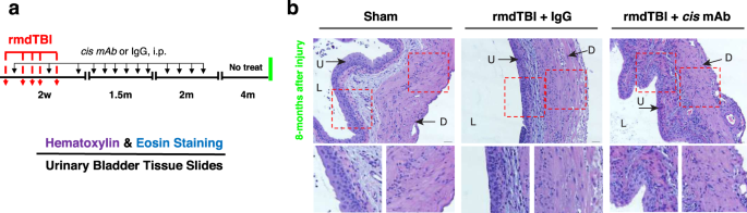Traumatic Brain Injury Related Voiding Dysfunction In Mice Is Caused By Damage To Rostral Pathways Altering Inputs To The Reflex Pathways Scientific Reports