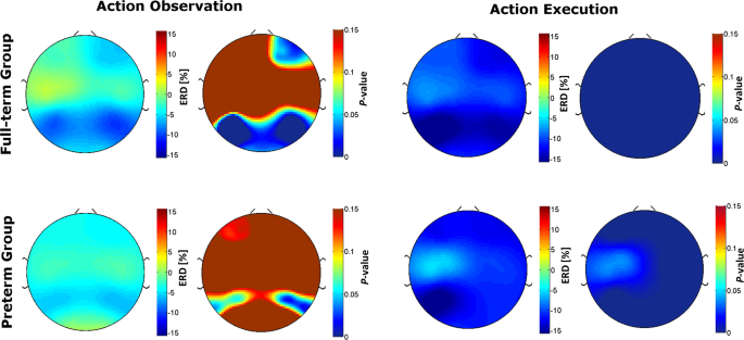 Exploring The Eeg Mu Rhythm Associated With Observation And Execution Of A Goal Directed Action In 14 Month Old Preterm Infants Scientific Reports