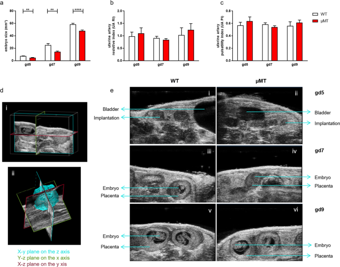 Il 10 Producing B Cells Rescue Mouse Fetuses From Inflammation Driven Fetal Death And Are Able To Modulate T Cell Immune Responses Scientific Reports